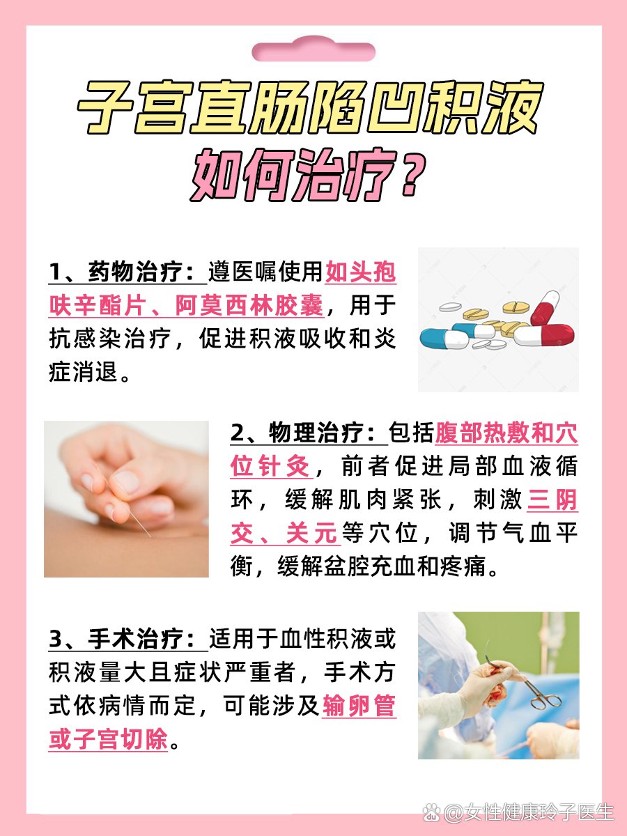 子宫直肠窝积液15mm,了解其成因、影响与应对策略子宫直肠窝积液是怎么回事15mm*11